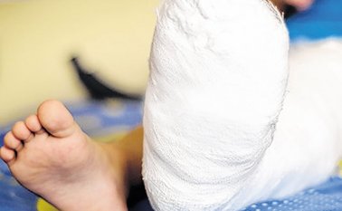 Expertos hicieron un llamado a los padres de familia para que estén alerta a los movimientos de sus hijos y prevengan accidentes que podrían dejar desde lesiones menores hasta la muerte. Colprensa