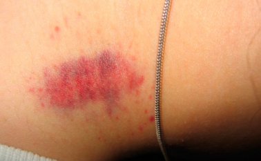 El joven habitante de Iztapalapa tenía una novia de 25 años. Internet | Referencial