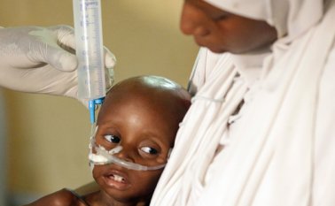 La crisis humanitaria en Nigeria es una de las más graves del mundo por su intensidad y el elevado número de niños en riesgo de muerte. AP