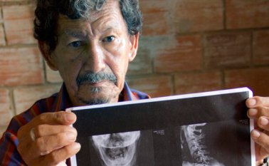 Luis Eduardo Bermúdez Caballero exhibe aquí la radiografía que muestra el daño que presenta en su columna vertebral. Luis Alfredo Estévez