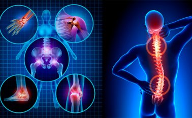 El 23% de las personas que sufren de dolor crónico lo asociaron a dolor craneofacial, según un estudio de la Asociación Colombiana para el Estudio del Dolor. Internet | Referencial