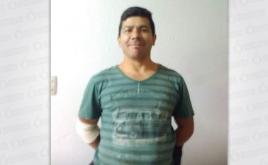 El agresor utilizó una segueta causándole una herida en el abdomen y en sus brazos. Cortesía