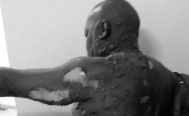 El mandatario de El Atrato ingresó al centro médico de Quibdó a las 11:43 pm del lunes. Colprensa