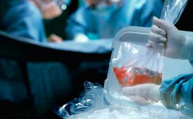 El año pasado murieron 72 personas en Santander a la espera de un trasplante. Colprensa