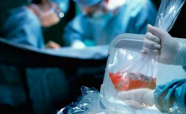 El año pasado murieron 72 personas en Santander a la espera de un trasplante. Colprensa