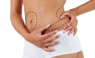 En cuanto al presente año, Medicina Legal informó que se han documentado 2 casos de muertes relacionadas con este tipo de procedimientos. Tomada de Internet