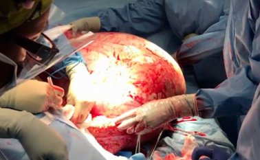 El tumor "la estaba matando lentamente", comentó Bouley el jueves durante una conferencia de prensa en el hospital. Internet