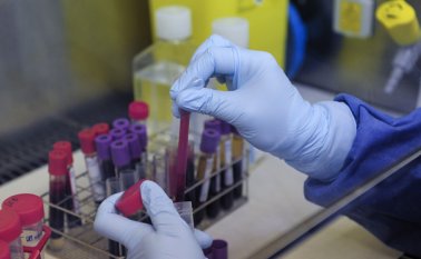 La Corte señaló que no había relación de su despido con el hecho de tener VIH/SIDA, porque este nunca informó sobre su enfermedad y, por tanto, la Alcaldía no solicitó el permiso debido al Ministerio de Trabajo. Archivo