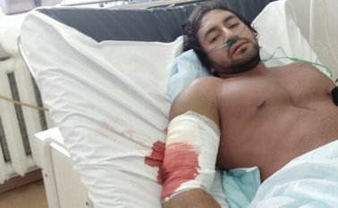 Esta foto fue tomada cuando Rodolfo Alexis Torres recién acaba de sufrir la ruptura de su músculo. Tomada de Facebook