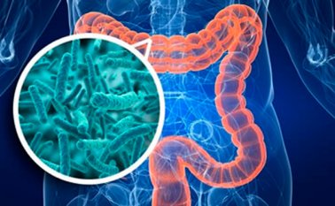 Estudios previos ya habían descubierto que hay flora o microbiota intestinal asociada al cáncer y que influye en su desarrollo y progresión. Instituto Nutrigenomica