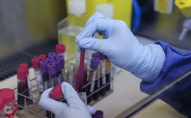 La mejor estrategia para combatir el virus de la inmunodeficiencia humana, según Onusida, es la promoción de la responsabilidad entre todos los habitantes. Colprensa