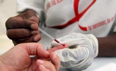 Prueba del Sida. Prensa Latina