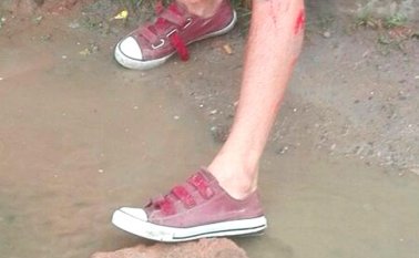 El hombre quedó en el piso y luego lo trasladaron al hospital. Cortesía