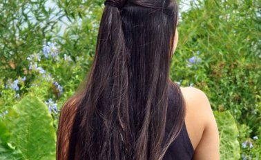 A la infante le fue practicado un procedimiento quirúrgico y se encuentran programadas dos intervenciones más. El País de Cali