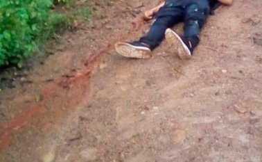 El hombre, aún sin identificar, recibió varios impactos de bala, uno de ellos en el rostro. Cortesía