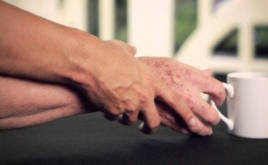 La app consiste en un software que captura el movimiento del paciente por medio del Kinect, dispositivo que viene con la consola de juegos Xbox. Internet