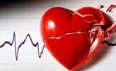 La población más afectada por esta enfermedad es aquella que supera los 60 años. Colprensa