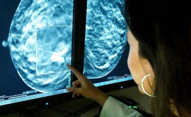 Controlar a tiempo las enfermedades, es la consigna del programa que se puso en marcha para las mujeres en Norte de Santander.
 Cortesía