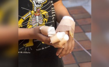 Seis personas resultaron quemadas con pólvora en la celebración del fin de año en Cúcuta y el área metropolitana. Archivo