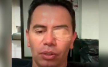 Rivera indicó que pese al dolor, siguió con su actuación, para no decepcionar al público que fue a verlo. Tomada de Twitter