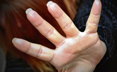 Lady Johana habría muerto a causa de un golpe con objeto contundente, lo que le generó un trauma craneoencefálico. Colprensa