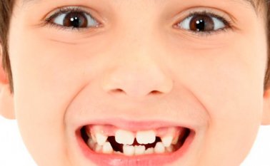 La especialista dijo que desde los primeros dientes se debe tener higiene bucal con ayuda de los padres. Colprensa