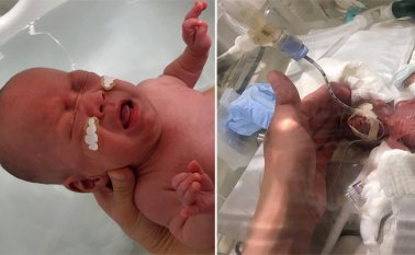 Los médicos habían provocado el nacimiento prematuro del bebé al cabo de tan solo 22 semanas de embarazo debido a una falta de crecimiento. AFP