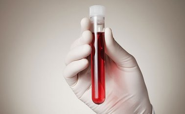 Cerca de 37 millones de personas viven con el VIH en todo el mundo.
Archivo Colprensa