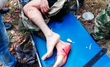 El ataque fue ejecutado con un artefacto explosivo accionado con cable mando de manera premeditada. Cortesía