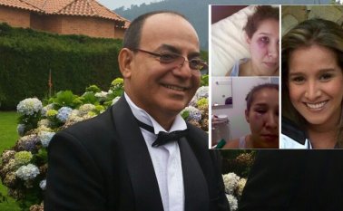 Este caso se volvió viral en internet, al punto de llegar a circular imágenes de la mujer agredida y memes con publicidad política cuestionando a Cuéllar. Archivo