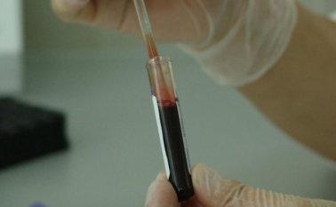 681 personas dieron positivo en las pruebas de VIH. Internet