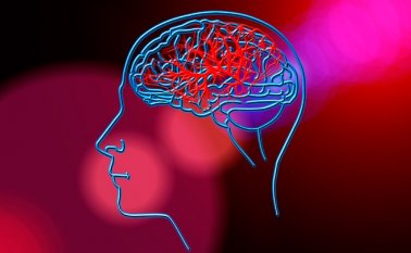 También conocido como isquemia cerebral. Se presenta cuando el cese del riego sanguíneo está causado por un coágulo que tapona un vaso sanguíneo del cerebro. También se le conoce con los nombres de trombosis o embolia. Pixabay