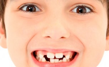 El profesional de salud orientará cómo tratar la situación sin que se torne riesgosa para el niño y sus padres. Colprensa