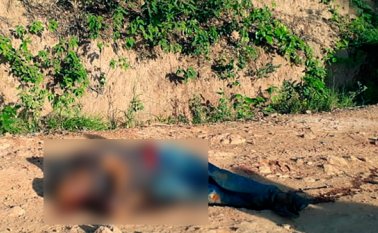 En uno de los impactos de bala que tenía Javier Enrique Bolívar Volve en su cara quedaron rastros de pólvora. Cortesía