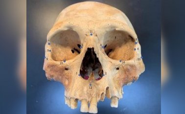 Utilizaron "puntos de referencia" faciales en 3D, como el tamaño de la cuenca del ojo o la longitud de una nariz, para analizar más de 100 cráneos. Colprensa