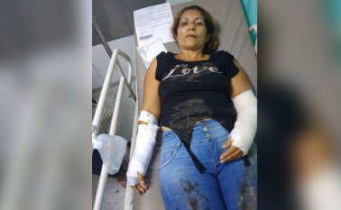 Tras la agresión, Nury García quedó con fracturas en los brazos y en la nariz. Cortesía