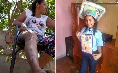 Ángela Barrada sufrió heridas tras quedarle la motocicleta encima. Yuliangel Acosta amaba coser y crear su propia ropa. Tras la gravedad de las heridas murió en hospital Erasmo Meoz. Alfredo Estévez