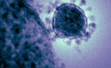 Coronavirus. Colprensa