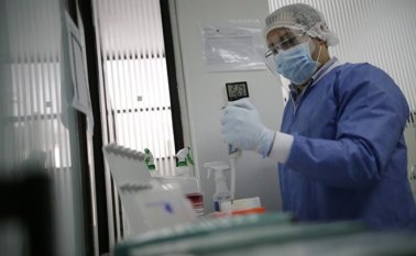 Pruebas Coronavirus Colprensa