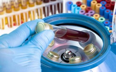 Se trata del ensayo clínico simple y los datos conocidos hoy se suman a la evidencia de trabajos previos. Colprensa.