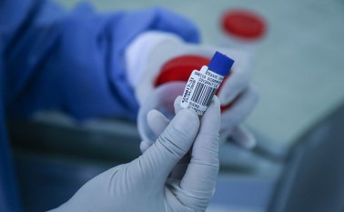 Laboratorio de almacenamiento y recepción de pruebas de COVID-19. Colprensa