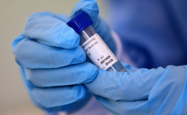Los pacientes son asintomáticos. Archivo
