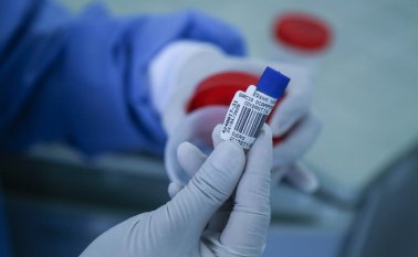 La principal preocupación es cómo funciona todo el tema de embalaje y oportuna toma de muestra, análisis y entrega de resultados, según el procurador general Fernando Carrillo. Archivo