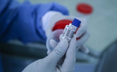 Según el director del IDS, Carlos Martínez, hace dos semanas había un represamiento de más de cuatro mil pruebas. Tras exigir resultados a las EPS, el fin de semana pasado quedaron 650 por evacuar. Archivo