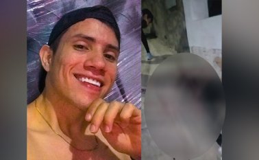 Un tiro en la cara recibió el joven cuando fue en busca de su motocicleta que dejó parqueada en una esquina. Archivo / La Opinión