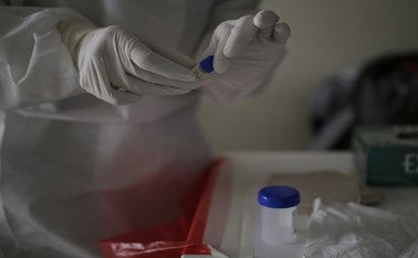 Ese número indica el porcentaje de la población que ha tenido contacto con la enfermedad y es un referente para entender el comportamiento del virus. Colprensa