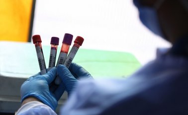 La donación de sangre no para a pesar de las nuevas restricciones de movilidad. Colprensa