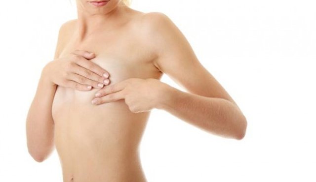 Autoexamen para detectar cáncer de mama. Colprensa