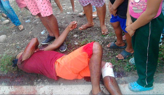 Wilson Ávila Flórez y una joven de 17 años resultaron heridos. Cortesía