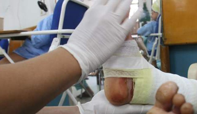 Más de 280 casos de quemados con pólvora se han registrado en 16 días. Colprensa